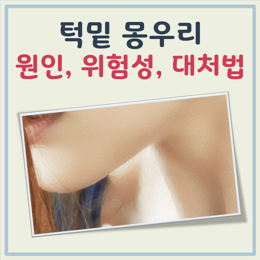 턱밑 몽우리 대표 이미지