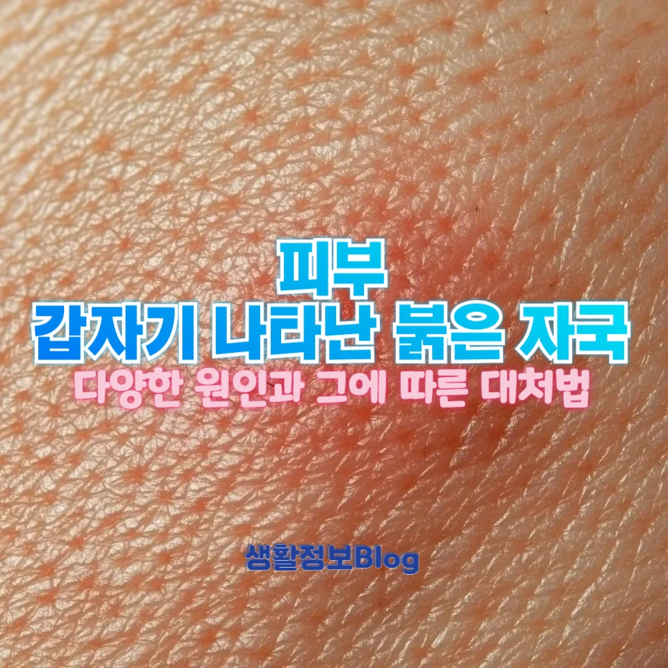 피부에 갑자기 생긴 붉은 자국