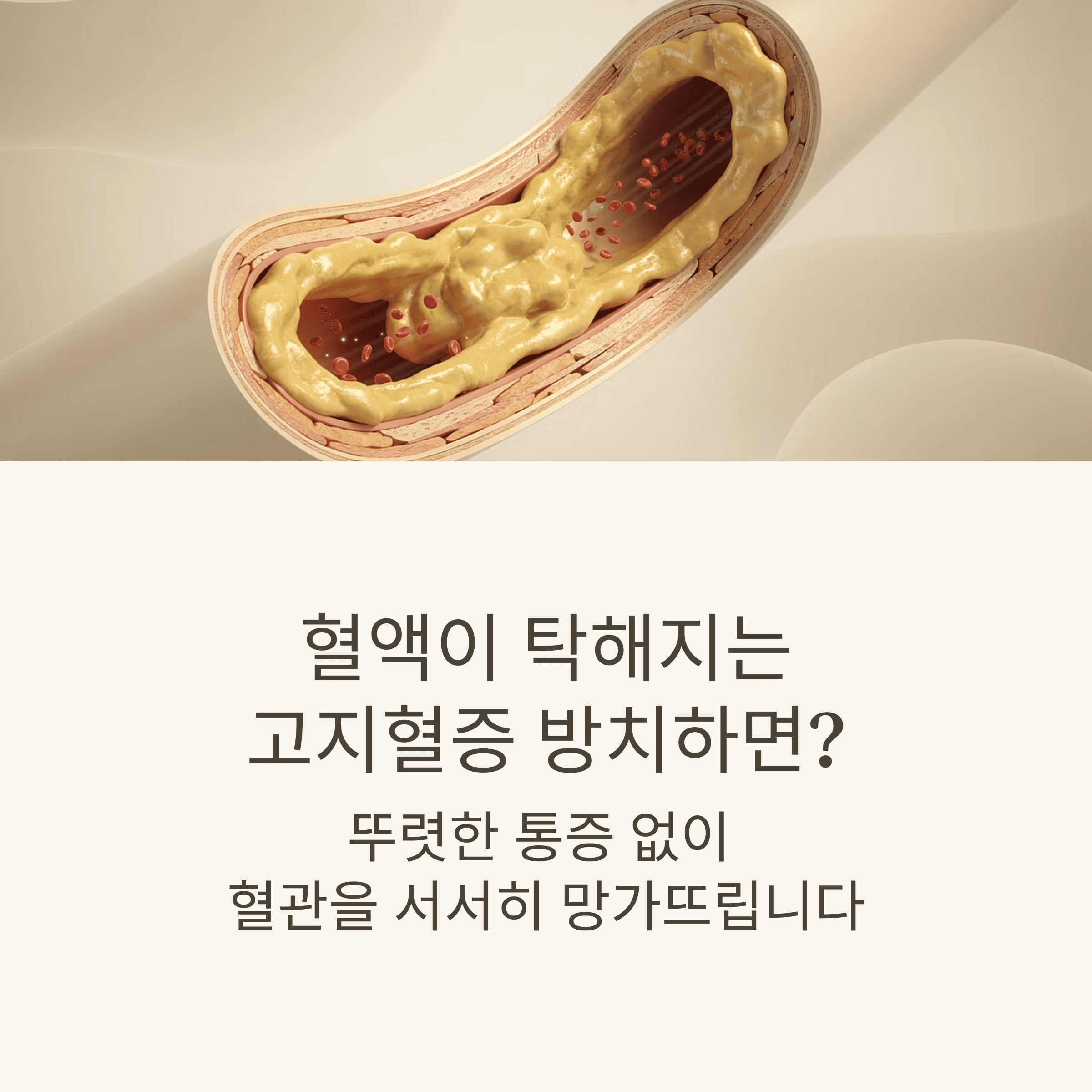 "고지혈증" 혈관 속 시한폭탄