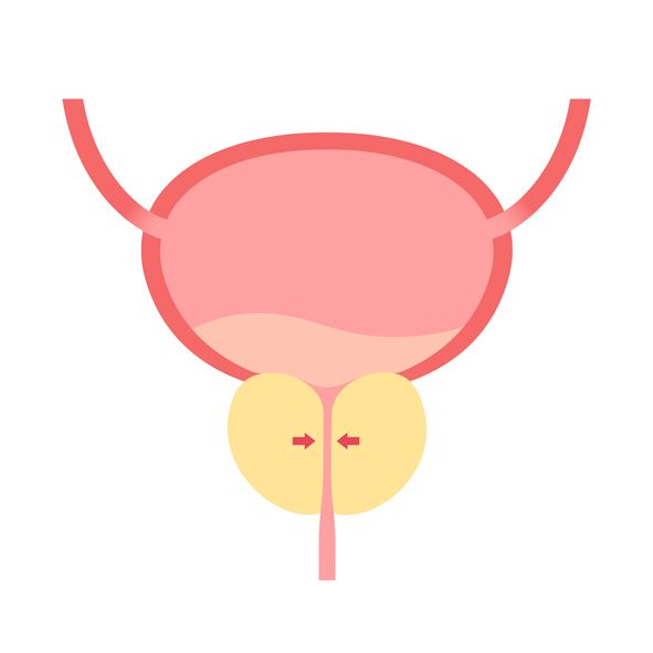 요실금 치료방법