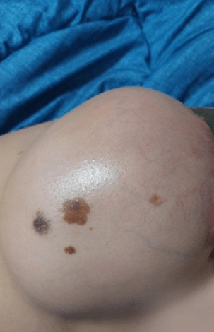 살이 불에 타는것 같아요2