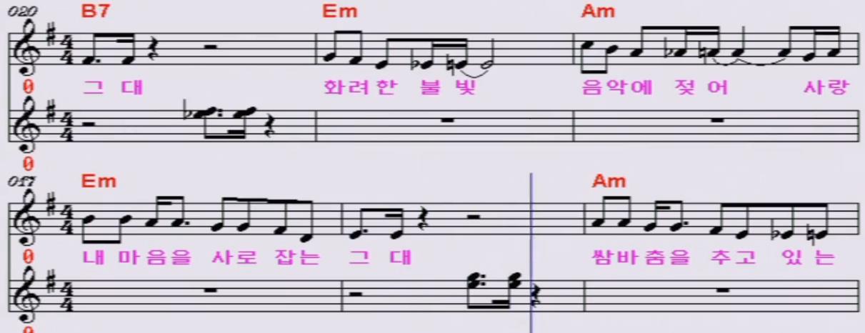 설운도: 쌈바의 여인