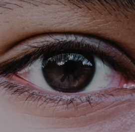 황반변성 치료법 자가진단 방법 합병증