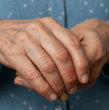 손가락 마디 아픈 이유 5가지1