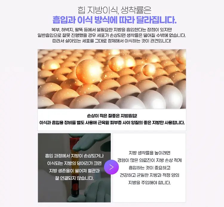 손상이 적은 질좋은 지방흡입과 이식&#44; 흡입용 장비를 별도 사용
