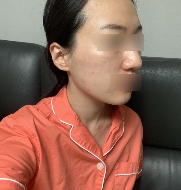 크라이오셀 후기