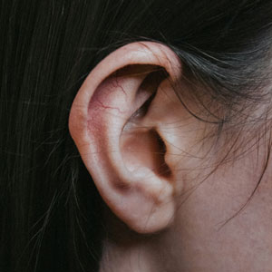 이석증 원인 - 머리 충격