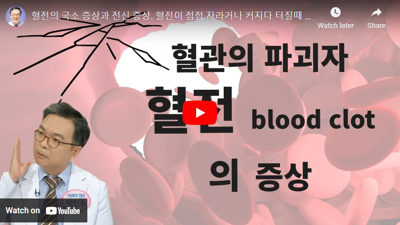 혈전 증상 관련 영상
