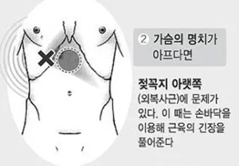 명치끝이 아픈이유 종류별 낫는법까지 완벽 해결_5