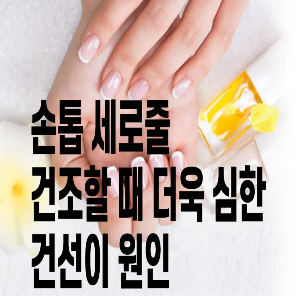 손톱-세로줄-건선-원인