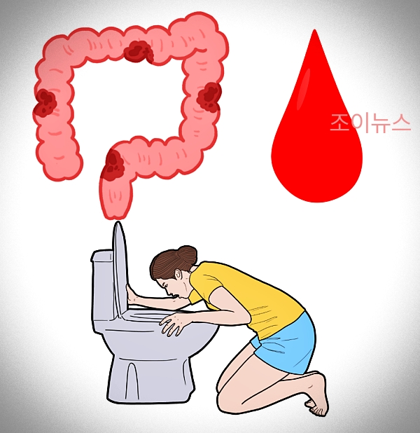 병원 치료가 꼭 필요한 복부팽만 증상들