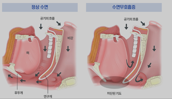 속지않고 제대로된 가습기 고르는 방법