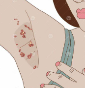 화농성 한선염