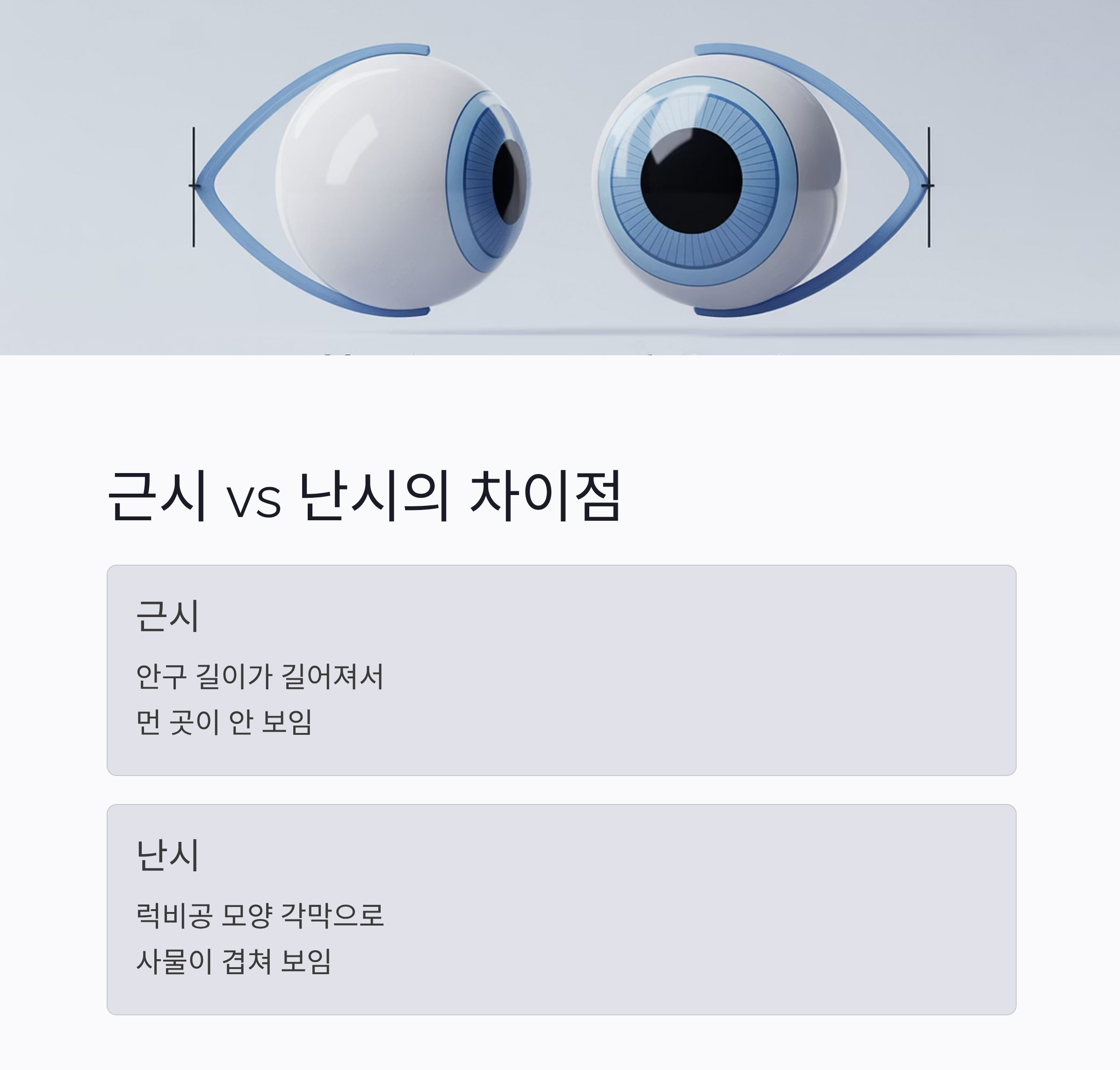 (근시,난시 차이점)