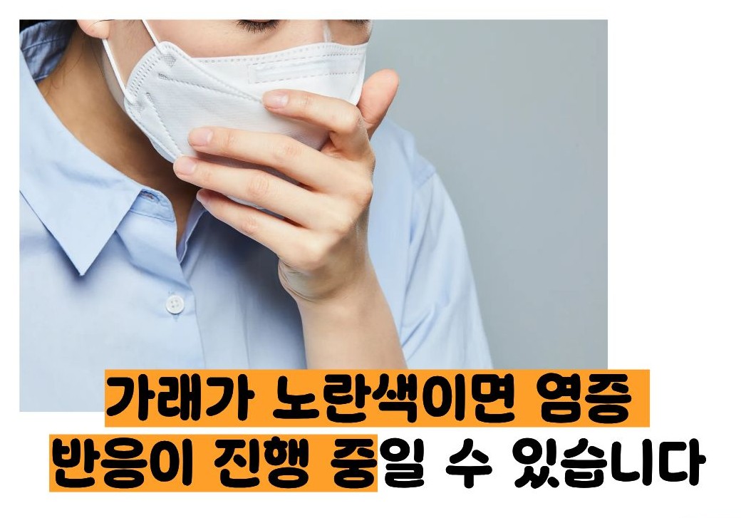 가래가 노란색