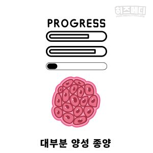 위저선 용종