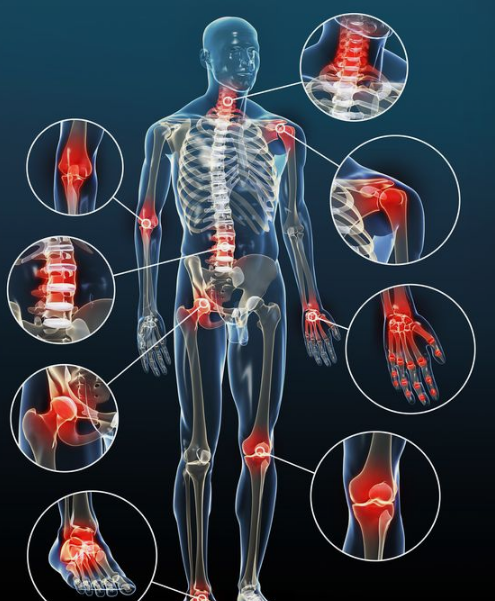 아르기닌 효능-염증-완화
