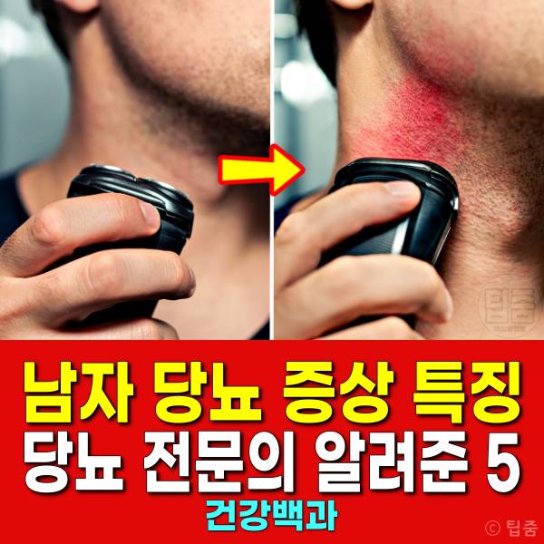 남자 당뇨 증상 특징 내분비내과 전문의 피셜