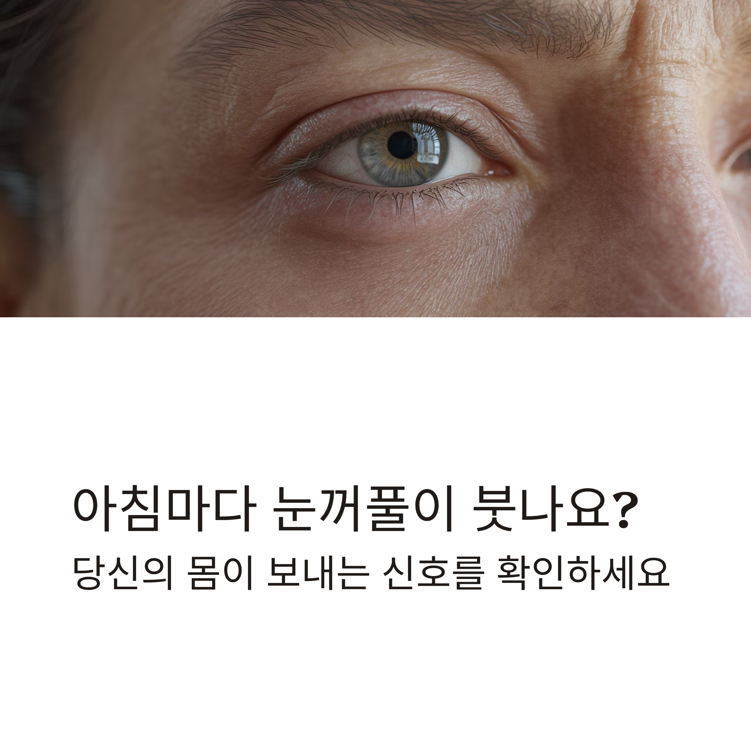 눈꺼풀이 붓는 이유, 원인과 해결 방법