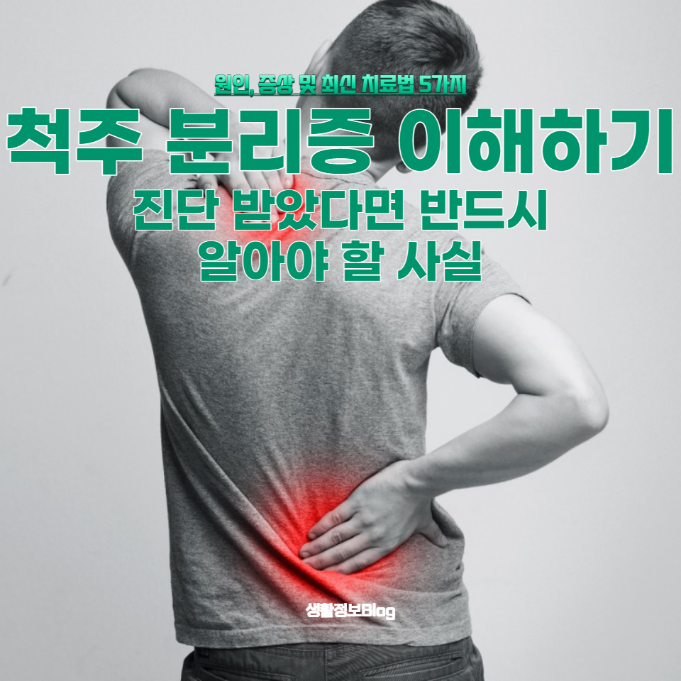 척주 분리증 환자를 위한 생활 가이드