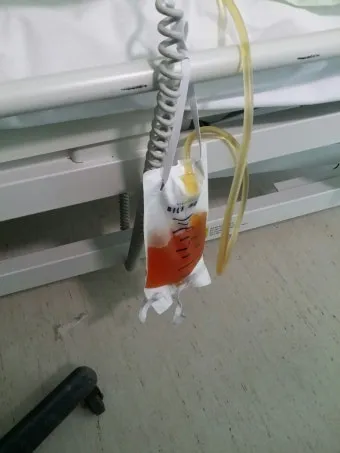 폐에 물이 차는 원인 증상 물참 관리 포인트에 대한 건강정보_18