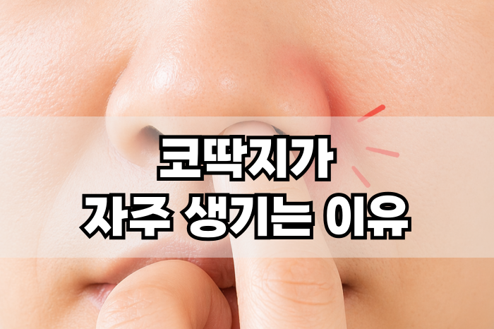 코딱지가 자주 생기는 이유