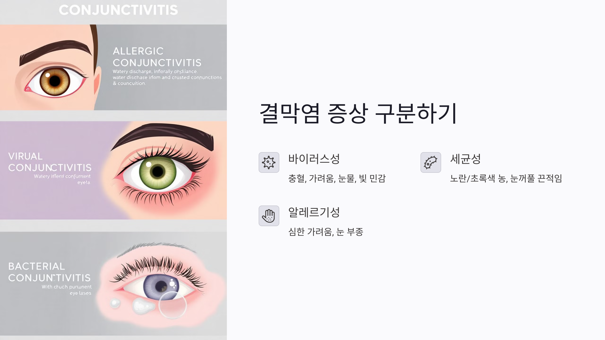 결막염 증상, 어떻게 구분