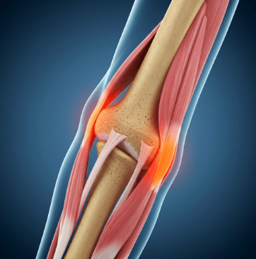 테니스 엘보 자가치료 방법3