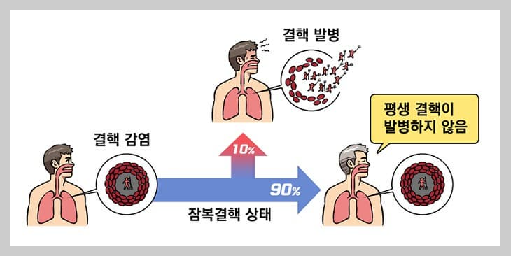 결핵 원인과 감염 단계