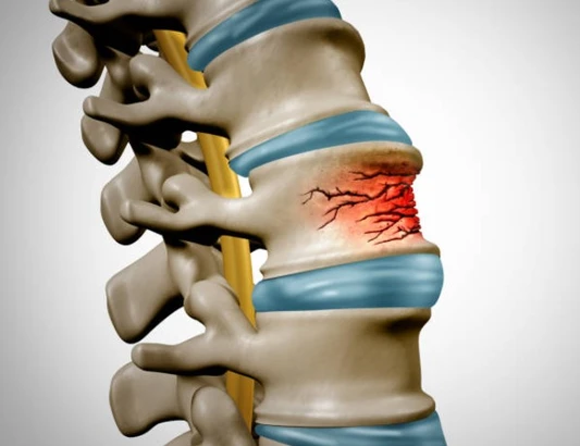 40대-50대-여성의-튼튼한-뼈를-위한-길잡이-골다공증-예방-및-관리-전략