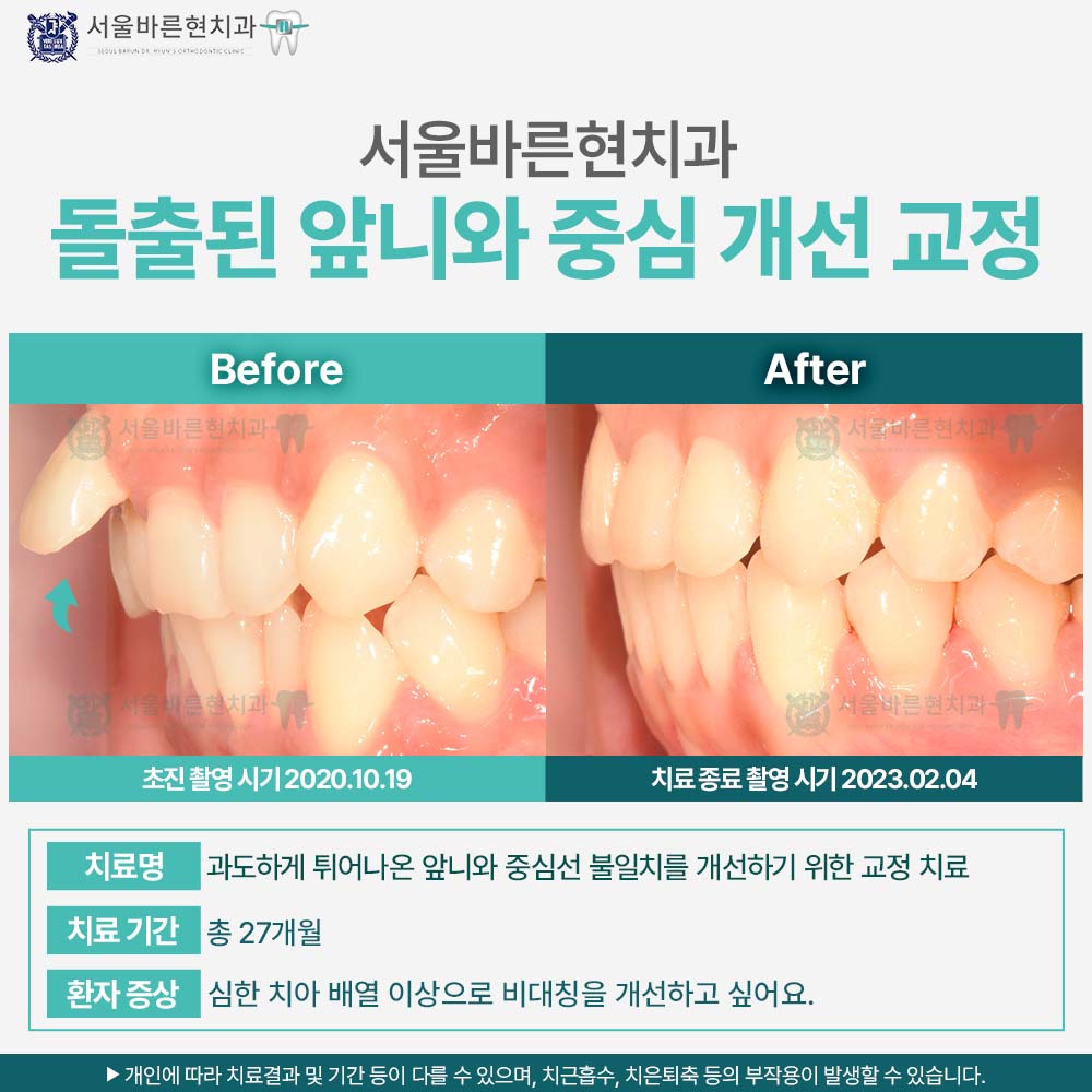 해운대교정치과
