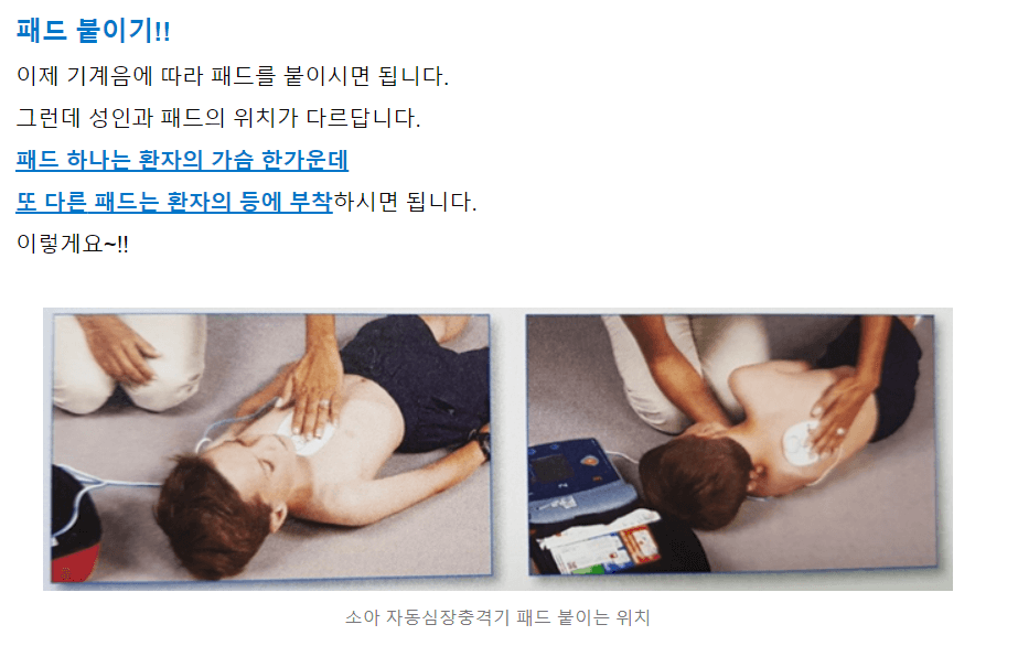 소아 자동심장충격기 패드 붙이는 위치 사진 설명