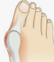 발바닥 통증부위