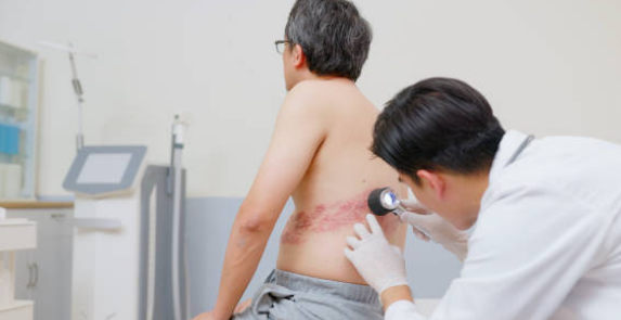 대상포진 증상&amp;#44; 전염&amp;#44; 치료방법 총정리 (2024ver)