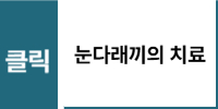 눈다래끼 치료