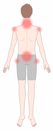 근육통 자주 발생하는 몸의 부위 뒷면