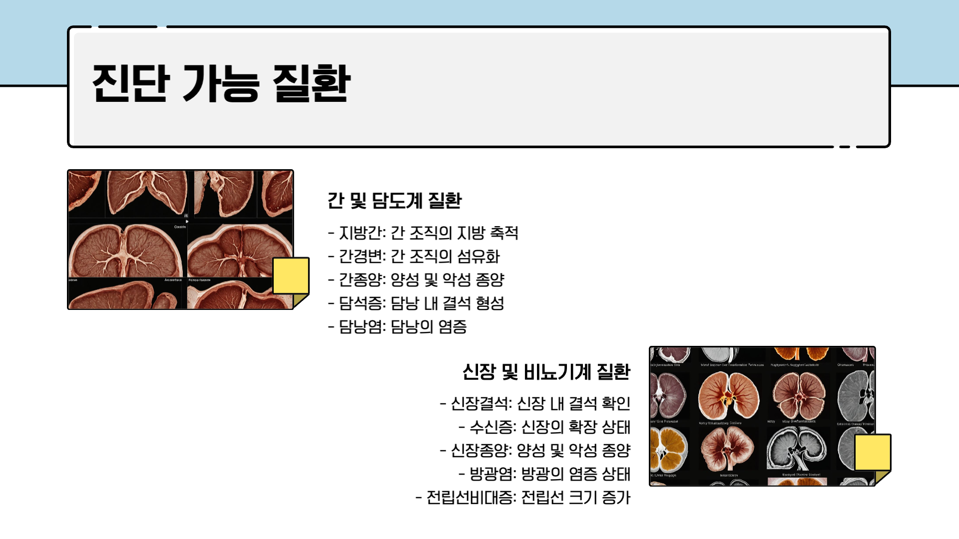 복부 초음파 검사로 알 수 있는 것