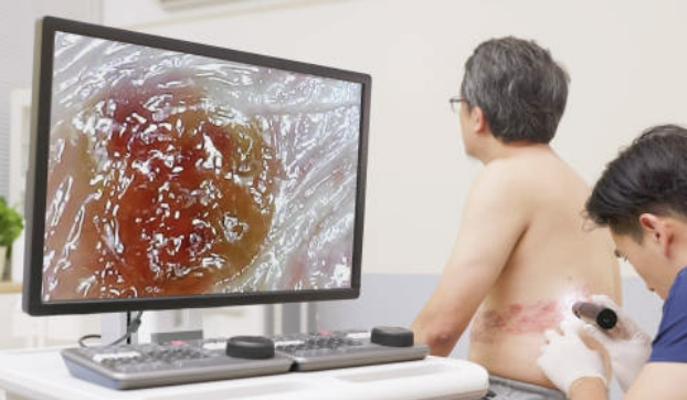 대상포진 예방접종 가격(최저가) 초기증상 치료방법 총정리