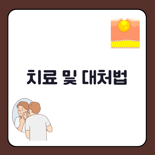 귓볼 낭종 치료 및 대처법
