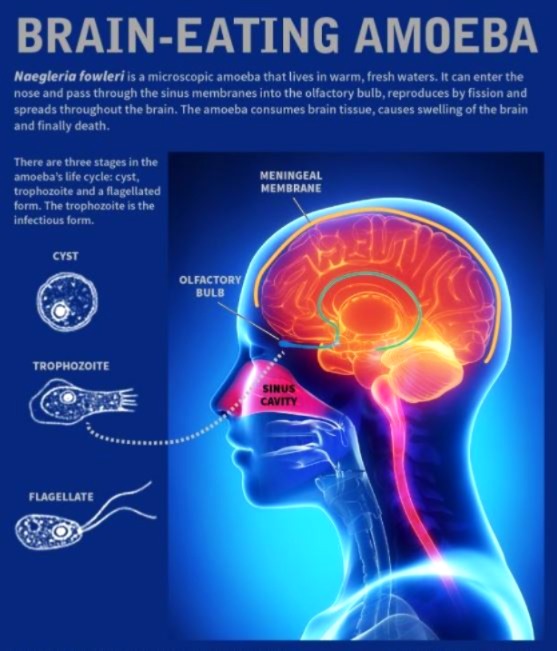 뇌먹는 아메바 설명 이미지