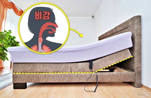 코골이 고치는법 매트리스 코골이방지 수술 치료