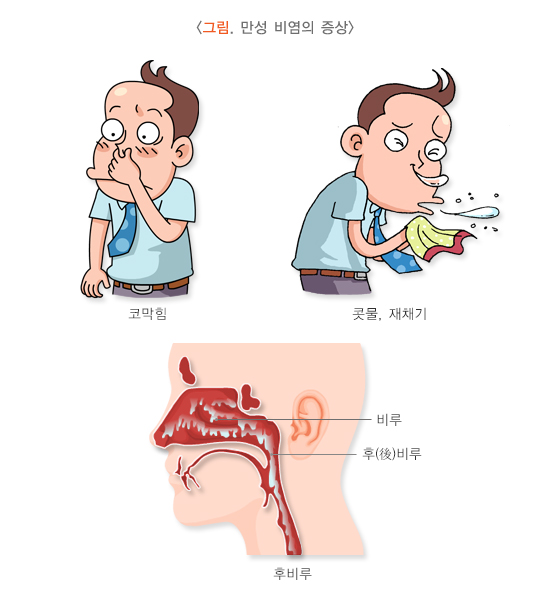 비염코막힘