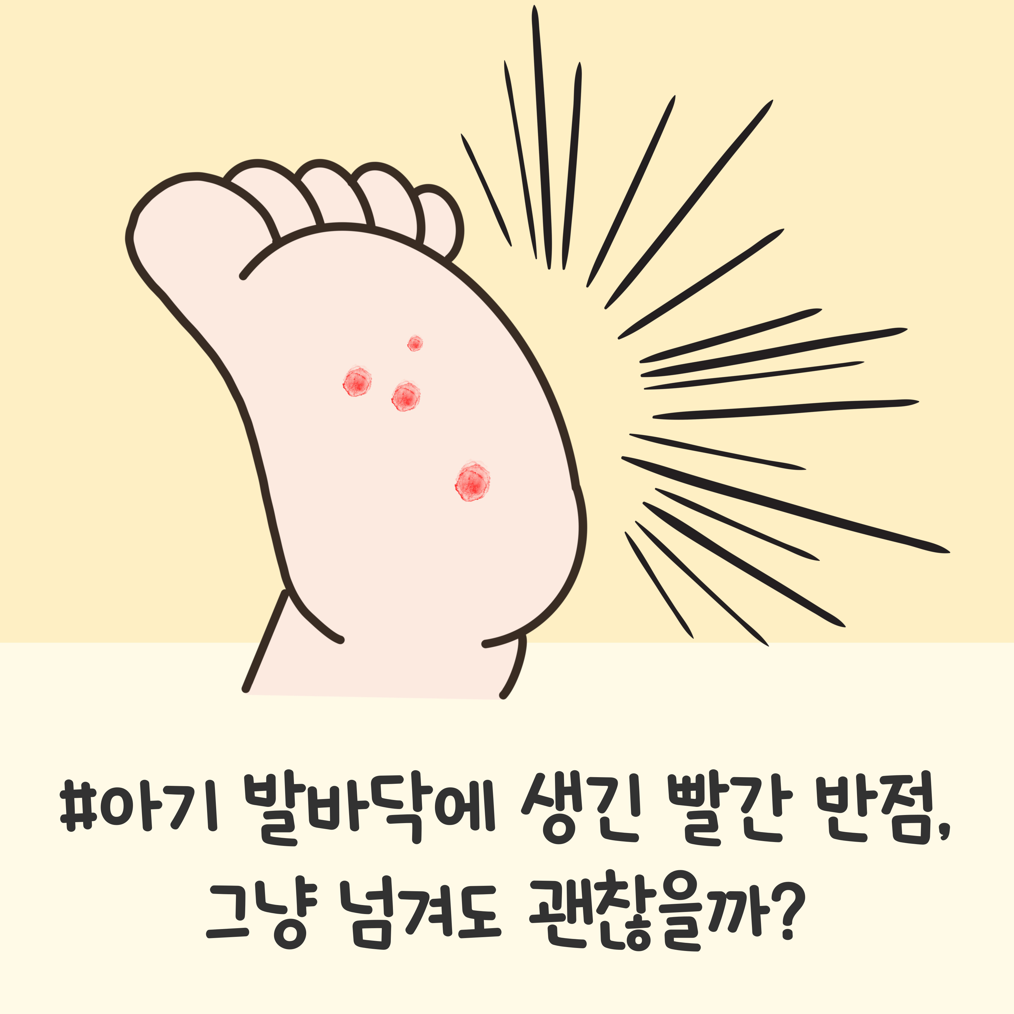 아기 발바닥 빨간 반점, 아기 자반증, 신생아 피부 발진