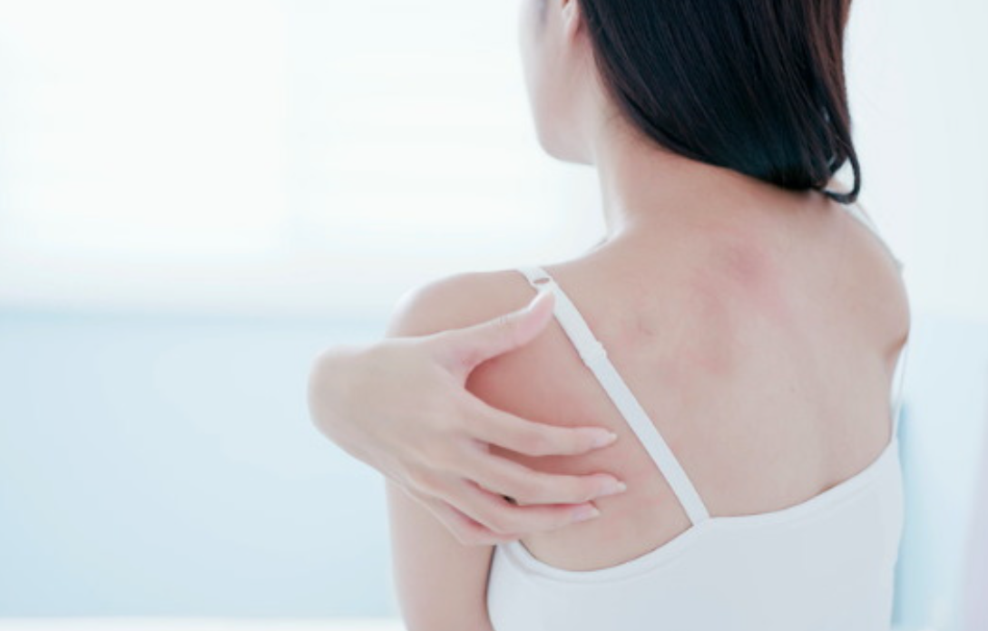 피부 통증과 감각 이상