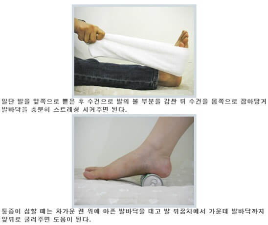 족저근막염 치료-마시지