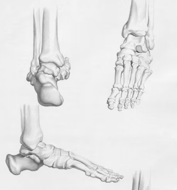 통풍 치료법 진단 기준 합병증