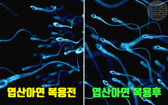 엽산 부족 증상 엽산효능 정자