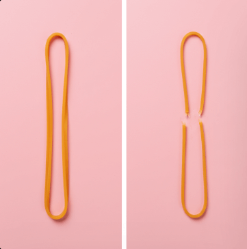 발목 염좌 vs 인대 손상 구분법2