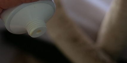 류마티스관절염