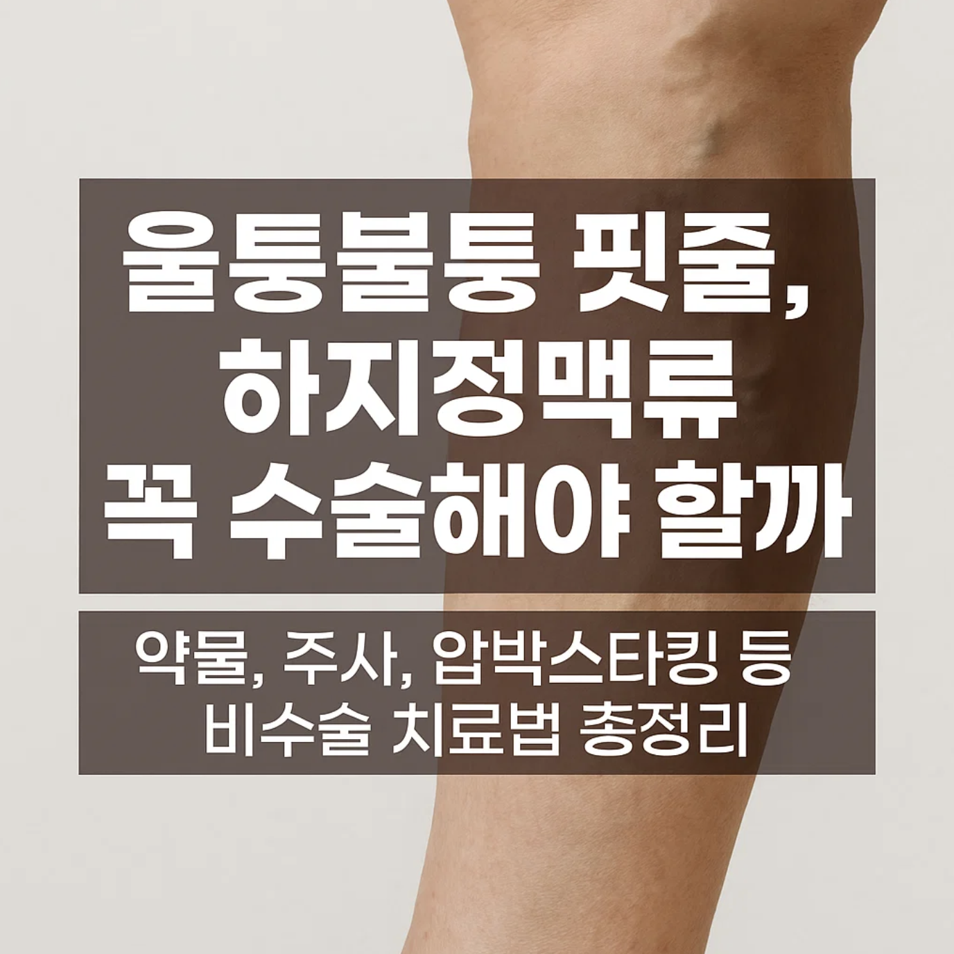 울퉁불퉁 핏줄, 하지정맥류 꼭 수술해야 할까? 약물, 주사, 압박스타킹 등 비수술 치료법 총정리